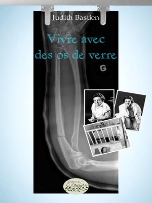 cover image of Vivre avec des os de verre